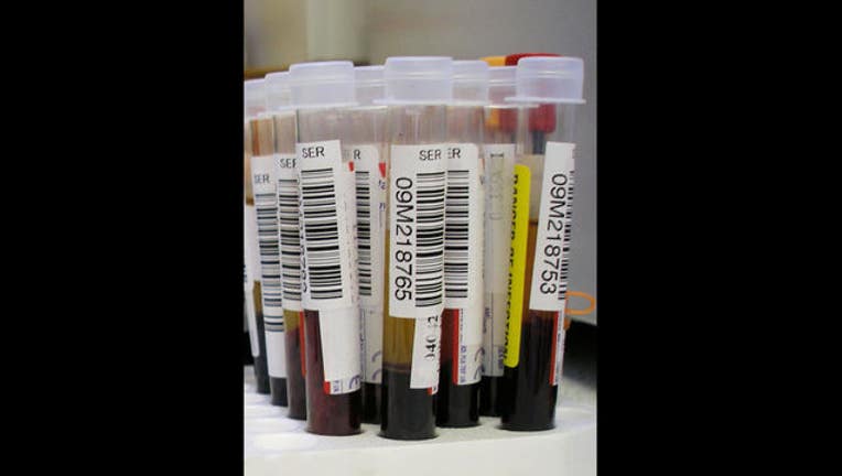 11f162a8-Blood_test_1450471416813.jpg