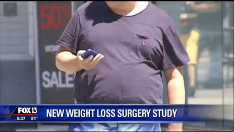 fbec0334-weight loss surgery_1444686339445.jpg
