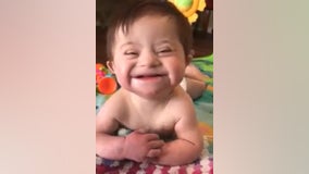 Video of adopted girl with Down syndrome smiling from ear to ear goes viral