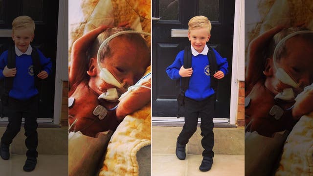 Mom celebrates premature son's first day of school after being told he would likely die