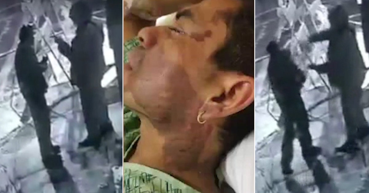 Milwaukee police arrest man in acid attack being investigated as hate ...