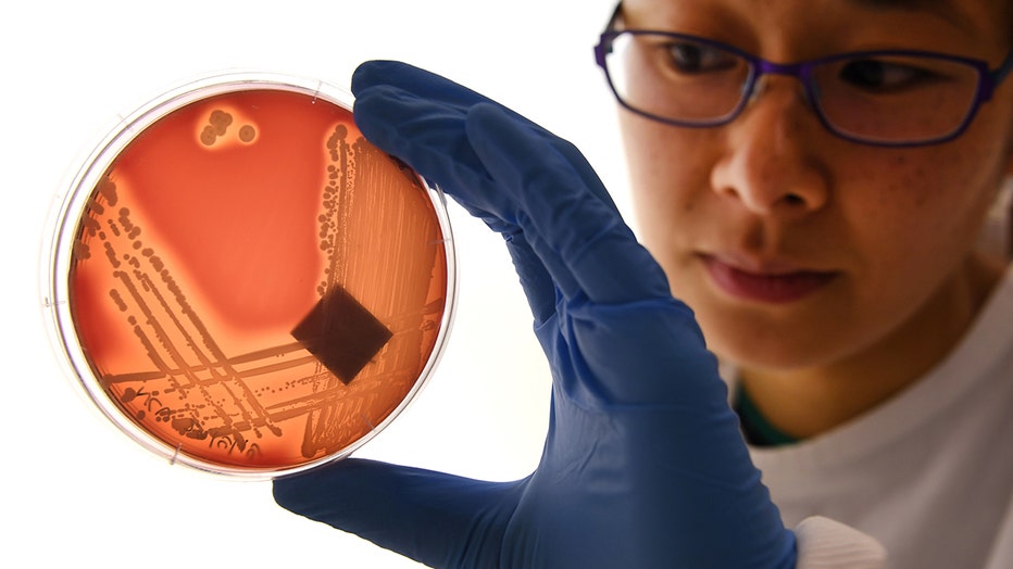 Jean Lee, a PhD student at Melbourne's Doherty Institute, inspects the superbug Staphylcocus epidermidis on an agar plate in Melbourne on September 4, 2018. Infections and deaths caused by antibiotic resistant superbugs are on the rise, according to a new report from the CDC.