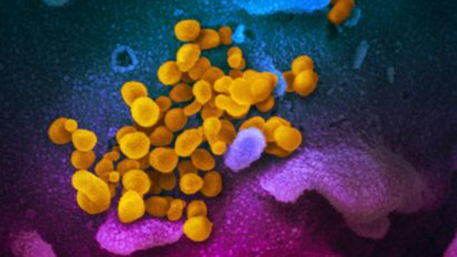 Tests: New coronavirus lives on some surfaces for days
