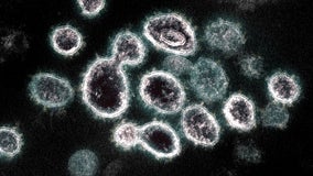 Deputies: Georgia couple refused to self-quarantine after positive coronavirus test