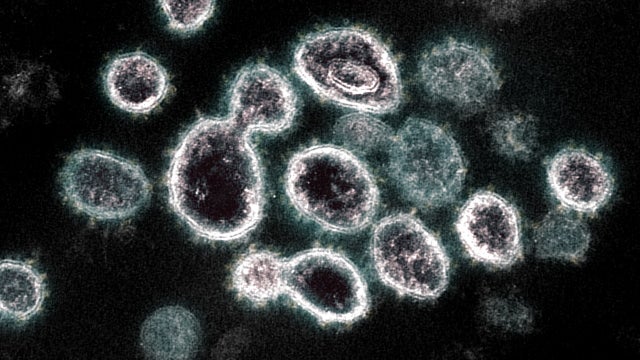 Figures: Coronavirus-related death toll topped 4,000 in the U.S.
