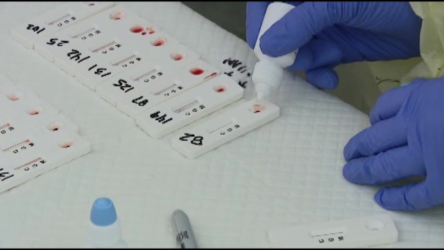 Experts want more research on COVID-19 antibodies as tests head to Florida