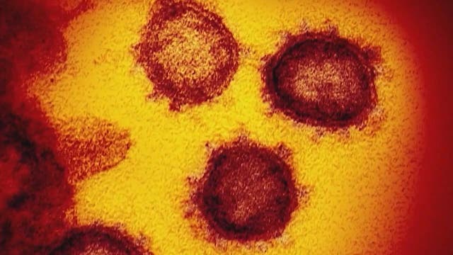 Study finds COVID patients with underlying issues 12 times more likely to die