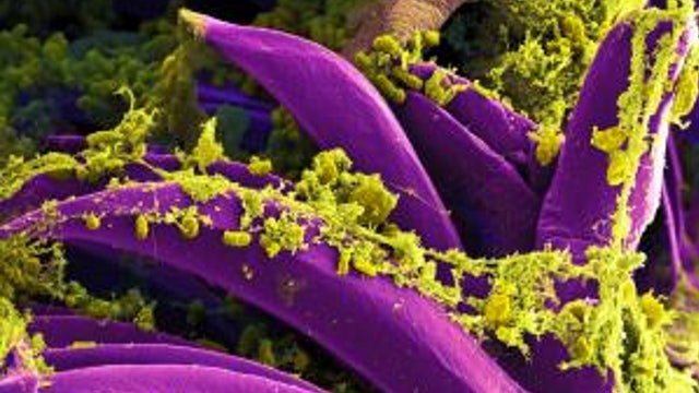 Case of bubonic plague reported in China's Inner Mongolia region