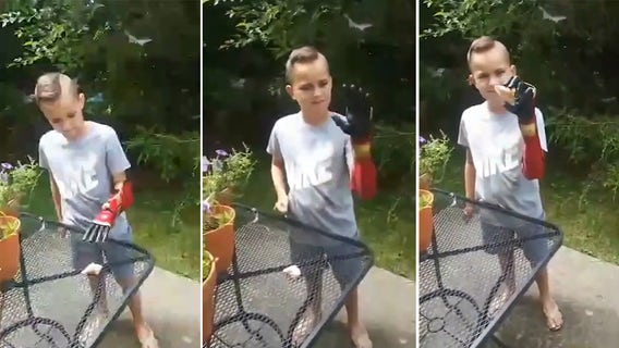 8-year-old amputee tests out Iron Man bionic arm