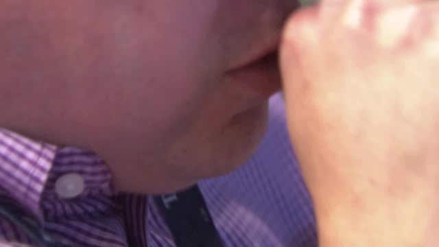 Hair loss, kidney damage, fatigue, emerge as possible long-term impacts of COVID-19