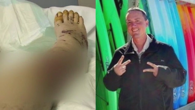 Mother desperate to help son hospitalized for months after being attacked by roommate's dogs