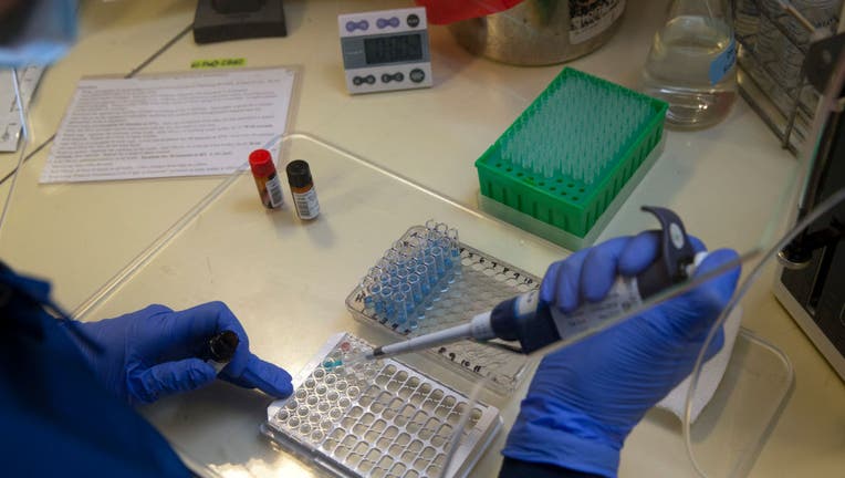 A medical laboratory scientist runs a clinical test.