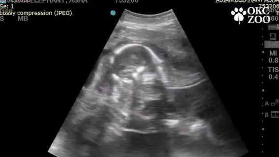 Oklahoma zoo shares ultrasound video of baby elephant due in 2022