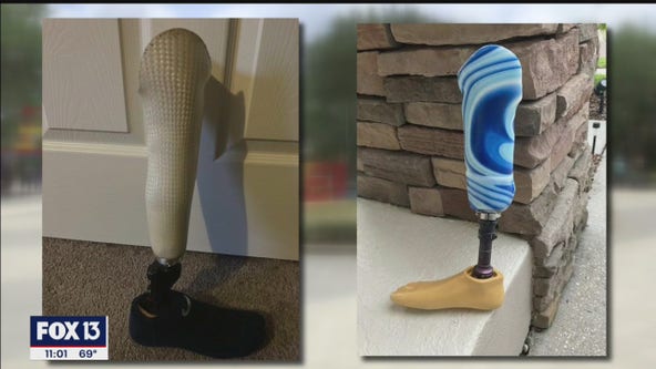 Suit claims park made boy remove prosthesis