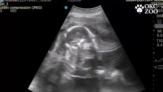 Oklahoma zoo shares ultrasound video of baby elephant due in 2022