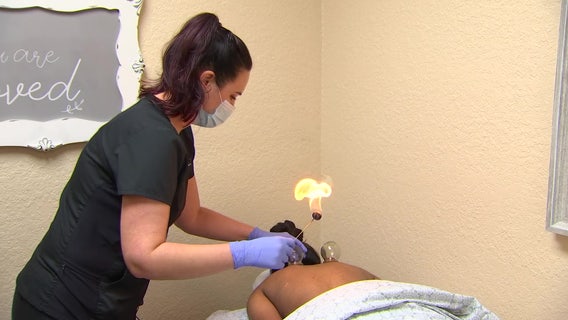 St. Petersburg clinic touts ancient form of cupping to heal muscles, reduce inflammation