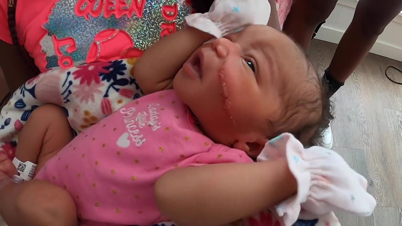 Newborn baby's face gets cut during emergency C-section