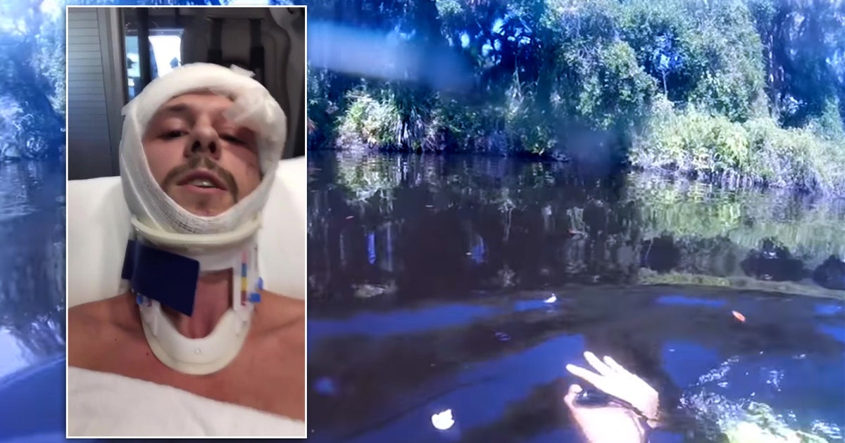 Alligator Explodes Injured diver 'freaked out' watching recovered GoPro footage of ...