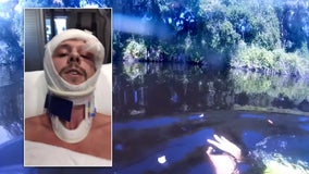 Injured diver 'freaked out' watching recovered GoPro footage of alligator attack