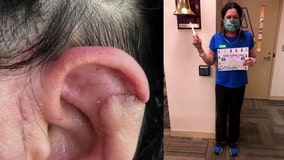 Experimental skin cancer vaccine developed in Tampa saves woman's life