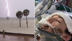 Family warns beachgoers one year after son was struck by lightning