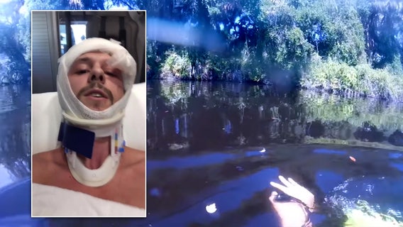 Injured diver 'freaked out' watching recovered GoPro footage of alligator attack