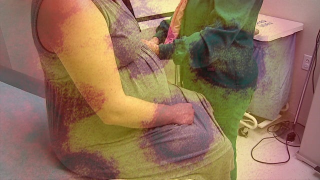 Pregnant women more likely to develop severe COVID symptoms, give birth prematurely, doctors say