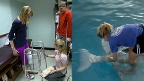 Boston bombing survivor with prosthetic leg shared special bond with Winter the dolphin