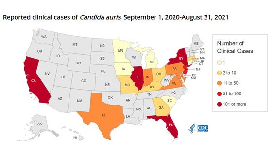 Drug-resistant fungus found at Louisiana hospital; 1st known case in state
