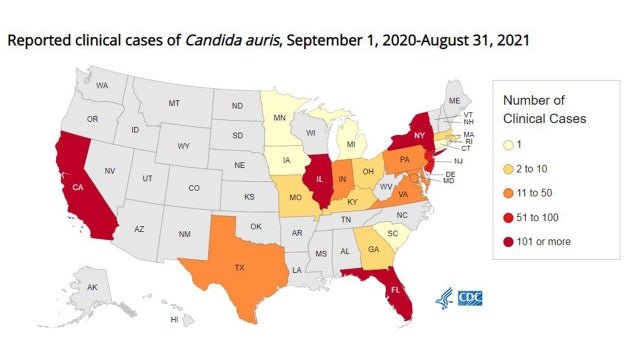 Drug-resistant fungus found at Louisiana hospital; 1st known case in state