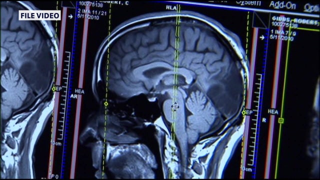 ‘Senior moments’ became more widespread during the pandemic, experts say