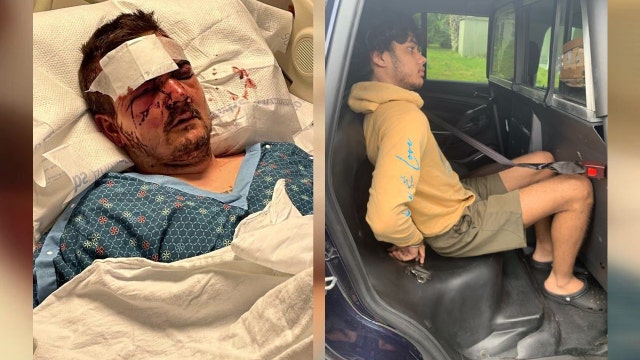Second suspect in Holmes Beach beating of disabled man walking his dog