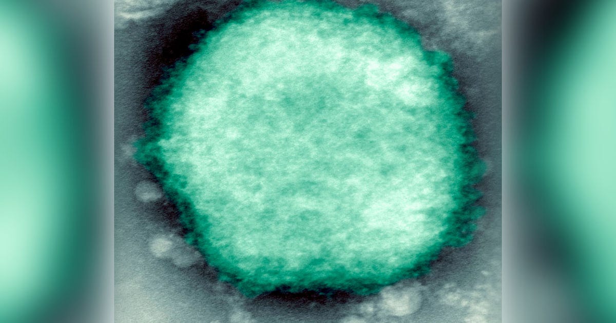 Monkeypox likely spread by sex at 2 raves in Europe, expert says | FOX ...