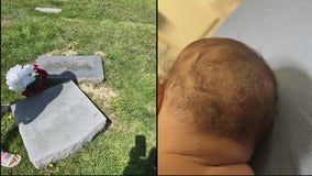 Baby suffers skull fracture after headstone falls on her at Detroit cemetery