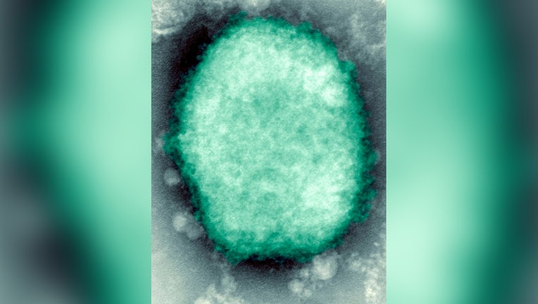 Monkeypox virus