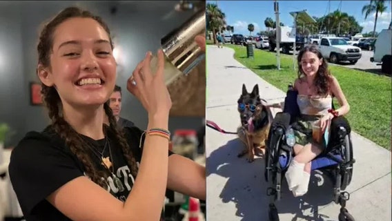 'It's heartwarming': Community hosts fundraiser for St. Pete woman who lost legs after COVID complications