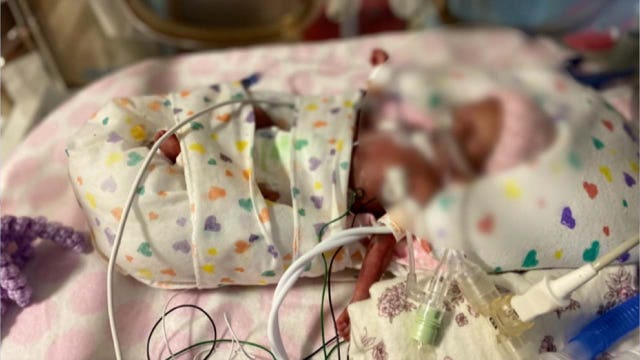 Guardian Ad Litem creates program allowing visits to substance-exposed newborns in NICU