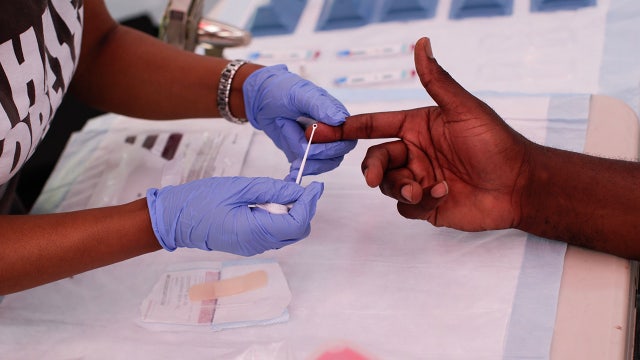 Free HIV testing offered at Tampa Walgreens