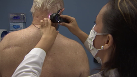 Free skin, head, neck and oral screenings at Clearwater Beach