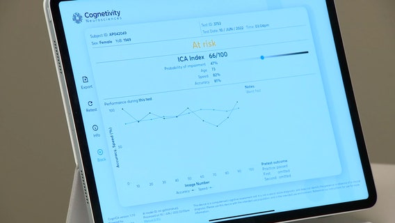 Clearwater doctor using new artificial intelligence-powered test to help spot early signs of dementia