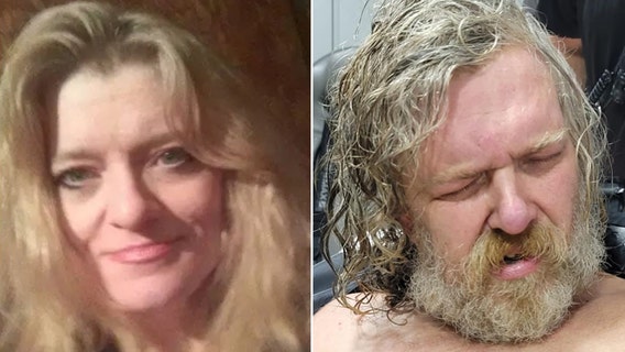 West Virignia woman wakes up from 2-year coma to name brother in attack