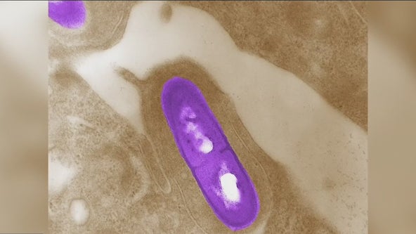 CDC looks at Florida as potential source for listeria outbreak