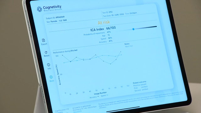 Clearwater doctor using new artificial intelligence-powered test to help spot early signs of dementia