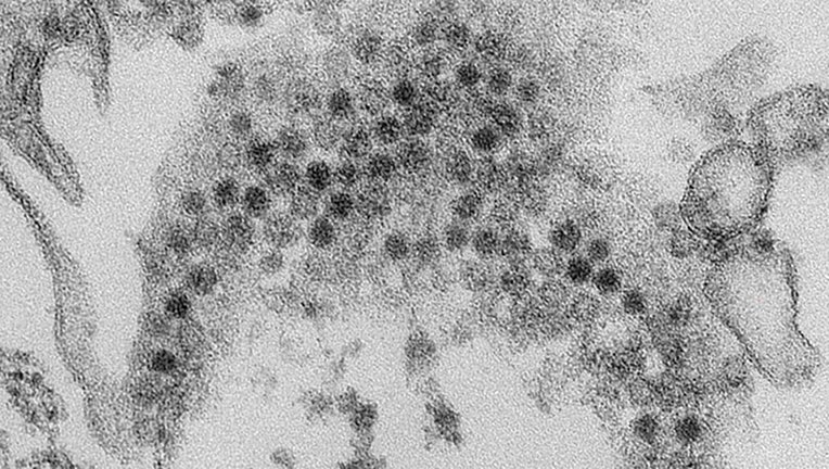 Photo: This photo shows an electron micrograph of a thin section of numerous, spherical EV-D68 viral particles.