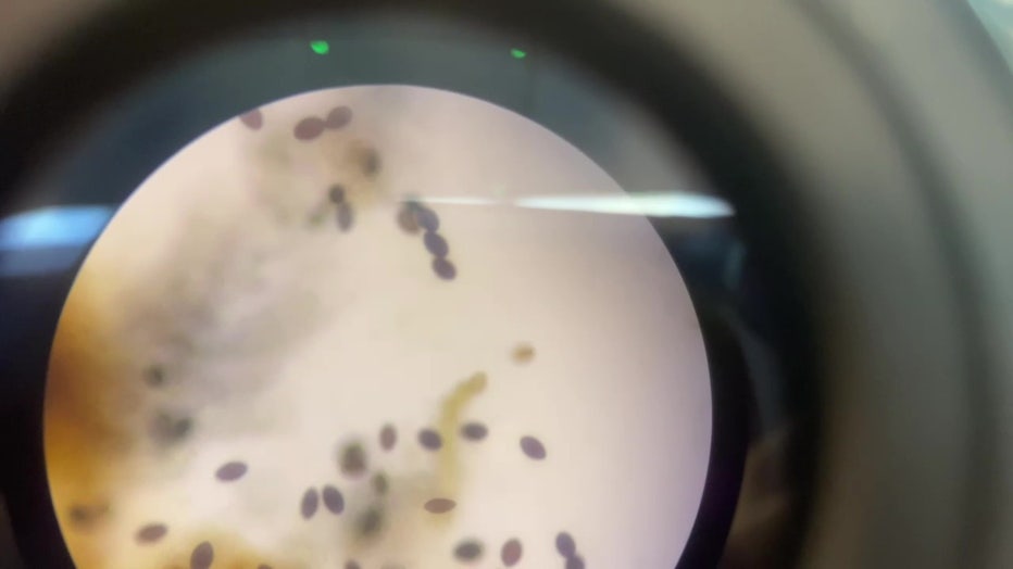Fungus under a microscope.