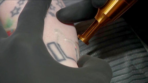 St. Pete tattoo shop offering free removal of gang or hate-related tattoos