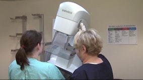 New mammogram guidelines impact half of American women with dense breast tissue