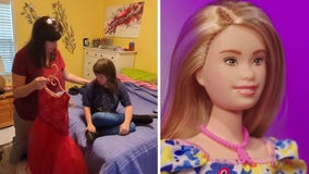 New Barbie doll with Down syndrome is sign of inclusion, acceptance for local families