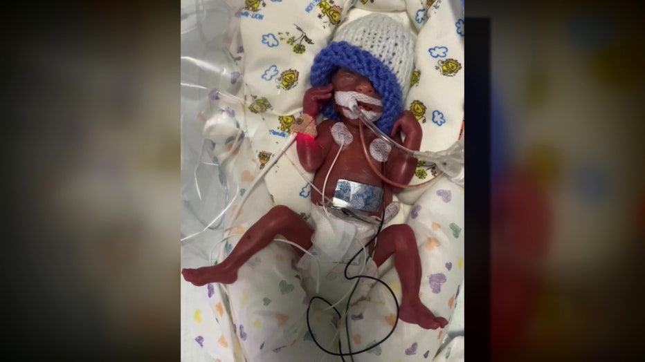 Liam McCasland spent months in the NICU.