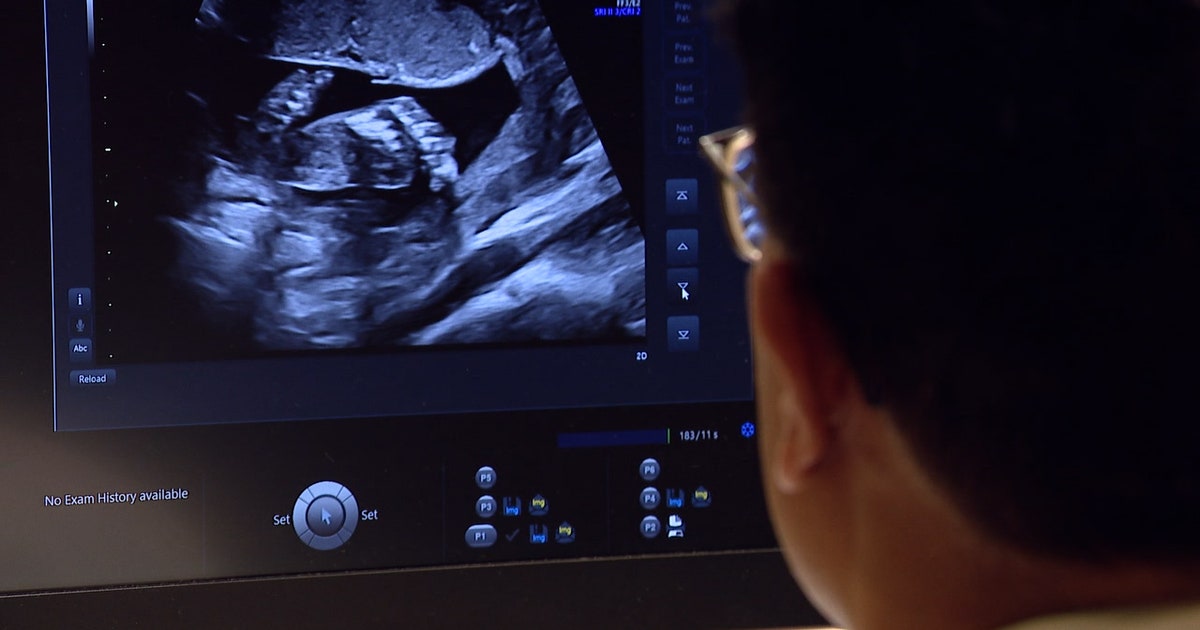 AdventHealth Tampa launches new OB-GYN residency program to address ...